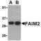 Fas apoptotic inhibitory molecule 2 antibody, 253369, Abbiotec, Western Blot image 