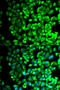 Thromboxane A Synthase 1 antibody, A04697, Boster Biological Technology, Western Blot image 