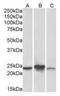 Abhydrolase Domain Containing 14B antibody, orb12328, Biorbyt, Western Blot image 