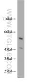 Pantothenate Kinase 2 antibody, 11001-1-AP, Proteintech Group, Western Blot image 