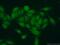 Ribosome Production Factor 2 Homolog antibody, 17584-1-AP, Proteintech Group, Immunofluorescence image 