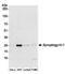 Synaptogyrin-1 antibody, A304-453A, Bethyl Labs, Western Blot image 