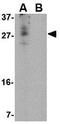 Cerebral dopamine neurotrophic factor antibody, GTX85431, GeneTex, Western Blot image 