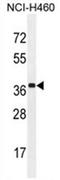 Zinc finger CCCH domain-containing protein 15 antibody, AP54621PU-N, Origene, Western Blot image 