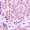 Kruppel Like Factor 11 antibody, LS-C353056, Lifespan Biosciences, Immunohistochemistry paraffin image 