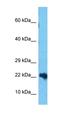 2'-Deoxynucleoside 5'-Phosphate N-Hydrolase 1 antibody, orb327353, Biorbyt, Western Blot image 