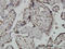 AT-Rich Interaction Domain 1B antibody, LS-C133798, Lifespan Biosciences, Immunohistochemistry frozen image 