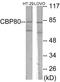 Nuclear Cap Binding Protein Subunit 1 antibody, EKC1782, Boster Biological Technology, Western Blot image 