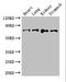 ATP Binding Cassette Subfamily G Member 8 antibody, LS-C676896, Lifespan Biosciences, Western Blot image 