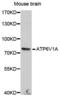 ATPase H+ Transporting V1 Subunit A antibody, A14707, ABclonal Technology, Western Blot image 