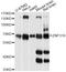 Zinc Finger Protein 319 antibody, LS-C749327, Lifespan Biosciences, Western Blot image 