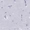 Stromal Antigen 3 antibody, PA5-61883, Invitrogen Antibodies, Immunohistochemistry paraffin image 