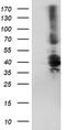 Dystrobrevin beta antibody, TA504320, Origene, Western Blot image 