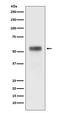 Retinoic Acid Receptor Alpha antibody, M00392, Boster Biological Technology, Western Blot image 