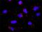 HLA-DQA1 antibody, H00003117-M01, Novus Biologicals, Proximity Ligation Assay image 
