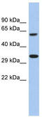 Calcium Homeostasis Modulator 3 antibody, TA335128, Origene, Western Blot image 