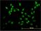 FIP antibody, H00007392-M03, Novus Biologicals, Immunocytochemistry image 