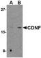 Cerebral Dopamine Neurotrophic Factor antibody, orb74888, Biorbyt, Western Blot image 