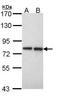Exostosin Glycosyltransferase 2 antibody, GTX101934, GeneTex, Western Blot image 