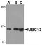 Ubiquitin Conjugating Enzyme E2 N antibody, SP2158P, Origene, Western Blot image 
