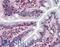 SS-A antibody, LS-B3096, Lifespan Biosciences, Immunohistochemistry frozen image 