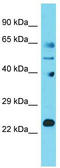 Josephin Domain Containing 1 antibody, TA337367, Origene, Western Blot image 