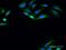 Pantothenate Kinase 4 antibody, H00055229-D01P, Novus Biologicals, Immunocytochemistry image 