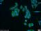 SH3 domain-binding protein 4 antibody, 17691-1-AP, Proteintech Group, Immunofluorescence image 