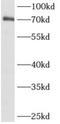 ALX Homeobox 3 antibody, FNab00353, FineTest, Western Blot image 