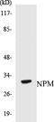 Nucleophosmin 1 antibody, EKC1407, Boster Biological Technology, Western Blot image 