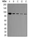 FER Tyrosine Kinase antibody, orb97009, Biorbyt, Western Blot image 