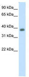 Neuronal Differentiation 2 antibody, TA343583, Origene, Western Blot image 