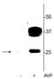 Aquaporin 2 antibody, P00935-2, Boster Biological Technology, Western Blot image 