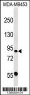 Calpain 13 antibody, 58-495, ProSci, Western Blot image 