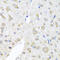 Eukaryotic translation initiation factor 3 subunit M antibody, 19-365, ProSci, Immunohistochemistry paraffin image 
