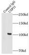Ubiquitin Specific Peptidase 11 antibody, FNab09306, FineTest, Immunoprecipitation image 
