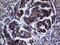 NADH:Ubiquinone Oxidoreductase Complex Assembly Factor 5 antibody, M11622, Boster Biological Technology, Immunohistochemistry paraffin image 
