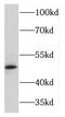 Potassium Voltage-Gated Channel Subfamily J Member 11 antibody, FNab04588, FineTest, Western Blot image 