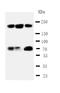 Tumor Protein P53 Binding Protein 1 antibody, LS-C313109, Lifespan Biosciences, Western Blot image 
