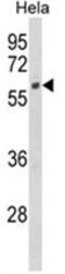 Cytochrome P450 Family 7 Subfamily B Member 1 antibody, AP17979PU-N, Origene, Western Blot image 