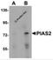 Protein Inhibitor Of Activated STAT 2 antibody, 5743, ProSci, Western Blot image 
