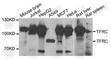 Transferrin Receptor antibody, A5865, ABclonal Technology, Western Blot image 