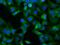 Nucleoredoxin Like 2 antibody, MA5-25121, Invitrogen Antibodies, Immunocytochemistry image 