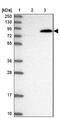 Ubiquitin carboxyl-terminal hydrolase 37 antibody, NBP1-82901, Novus Biologicals, Western Blot image 