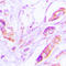 Vascular Endothelial Growth Factor D antibody, LS-C352199, Lifespan Biosciences, Immunohistochemistry paraffin image 