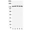 Suppression Of Tumorigenicity 5 antibody, R31411, NSJ Bioreagents, Western Blot image 