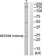 SEC22 Homolog B, Vesicle Trafficking Protein (Gene/Pseudogene) antibody, TA314932, Origene, Western Blot image 