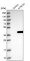 5'-Nucleotidase, Cytosolic IIIA antibody, NBP1-85525, Novus Biologicals, Western Blot image 