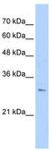Rhomboid Like 2 antibody, TA342040, Origene, Western Blot image 