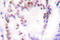 Histone Deacetylase 9 antibody, LS-C176063, Lifespan Biosciences, Immunohistochemistry paraffin image 